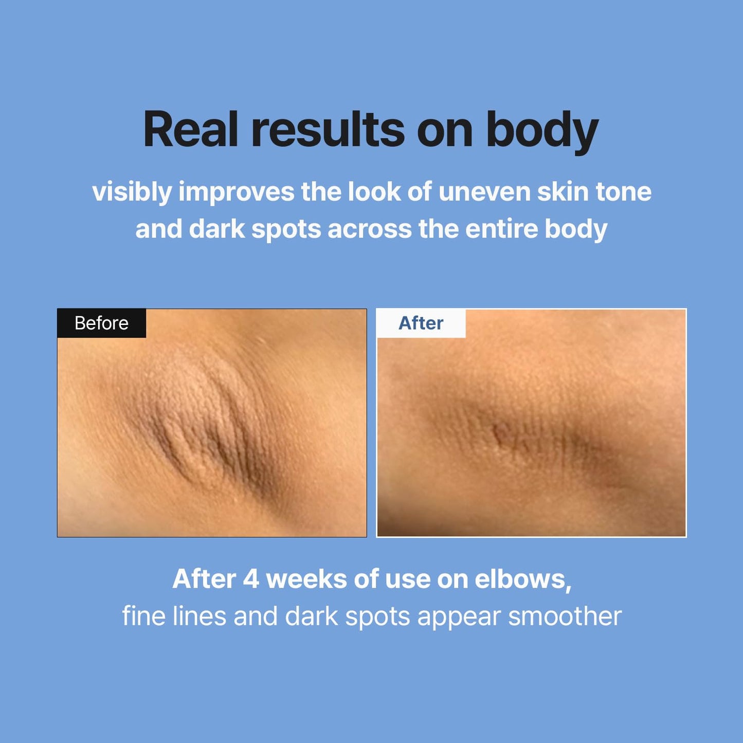 MEDITHERAPY Retinal Skin Booster Serum - Retinaldehído no irritante para principiantes para cara y cuerpo - Minimizador de poros de retinol antienvejecimiento para piel propensa a imperfecciones