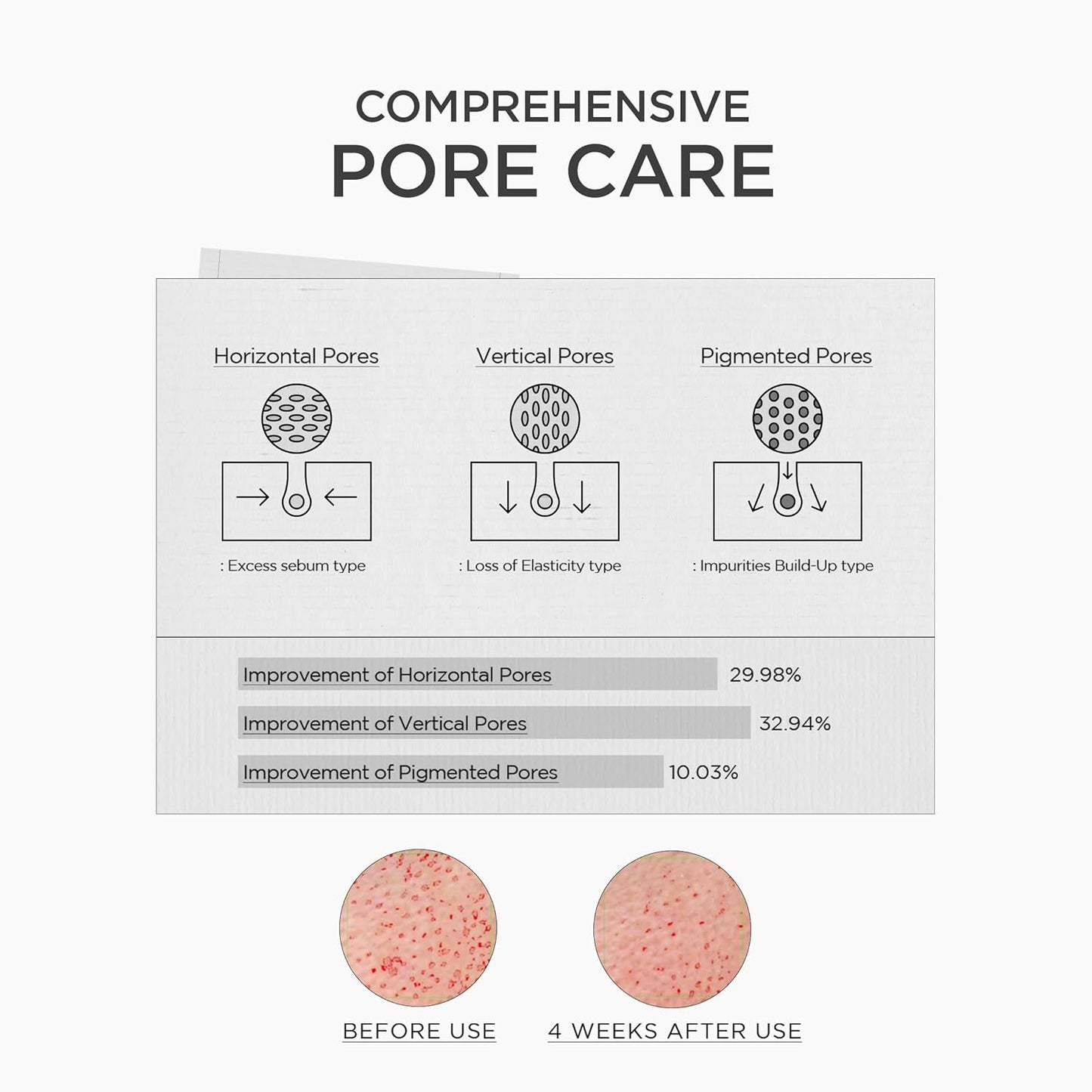 SKIN1004 Ampollón de Impulso de Niacinamida 10%, 1.01 fl.oz, 30ml, Suero Hidratante de Niacinamida, Suero Facial Concentrado Coreano con Ácido Tranexámico, Centella de Madagascar, Cuidado de la Piel