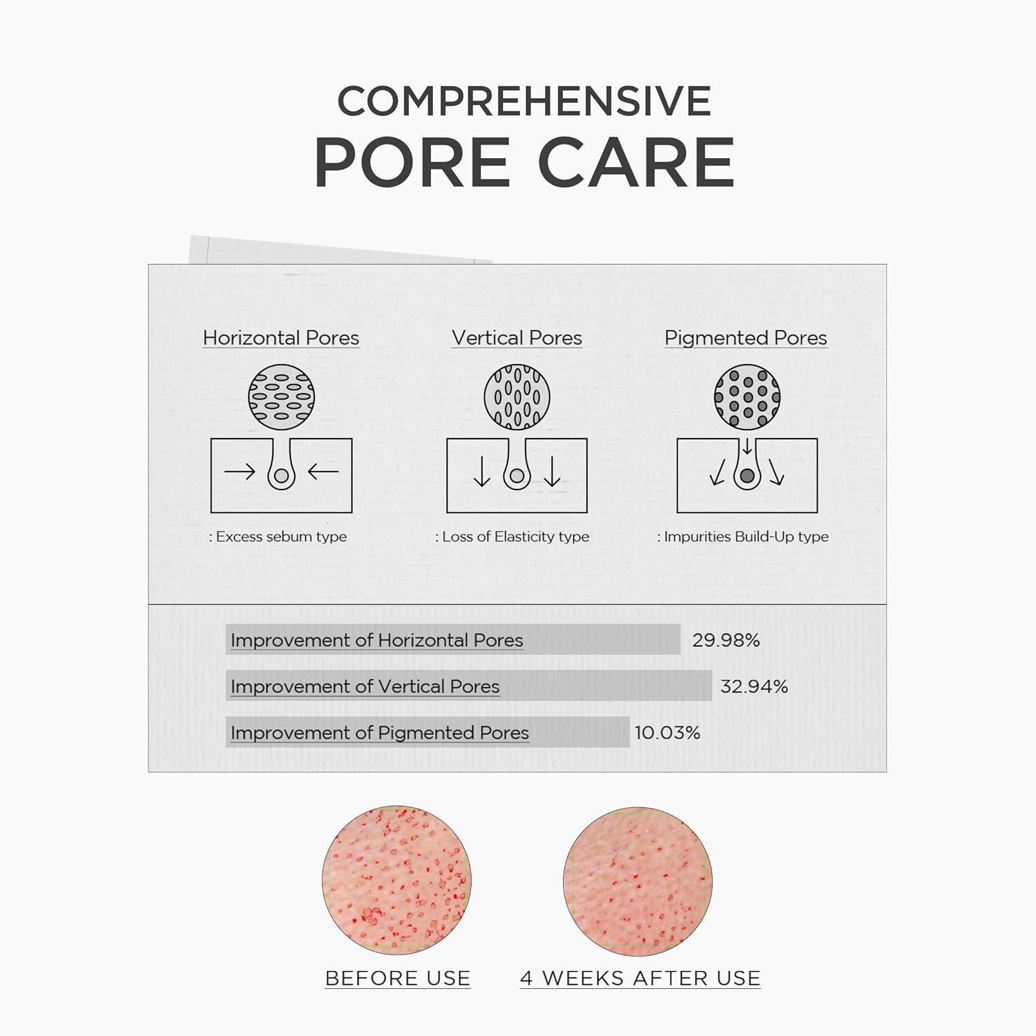 SKIN1004 Ampollón de Impulso de Niacinamida 10%, 1.01 fl.oz, 30ml, Suero Hidratante de Niacinamida, Suero Facial Concentrado Coreano con Ácido Tranexámico, Centella de Madagascar, Cuidado de la Piel