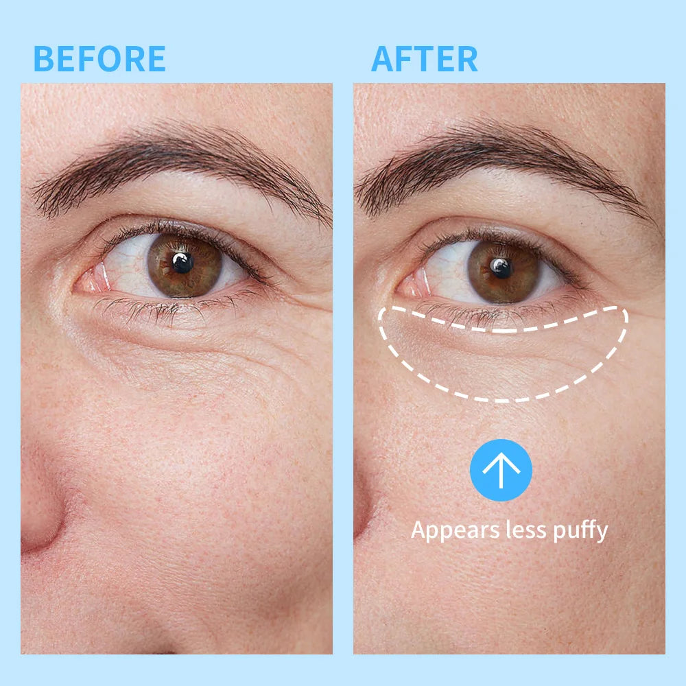 Gel hidratante y humectante para ojos Lakerain para ojeras