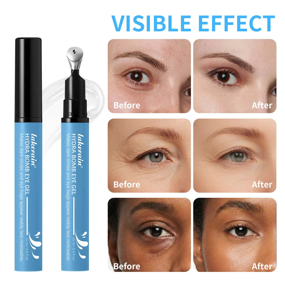 Gel hidratante y humectante para ojos Lakerain para ojeras