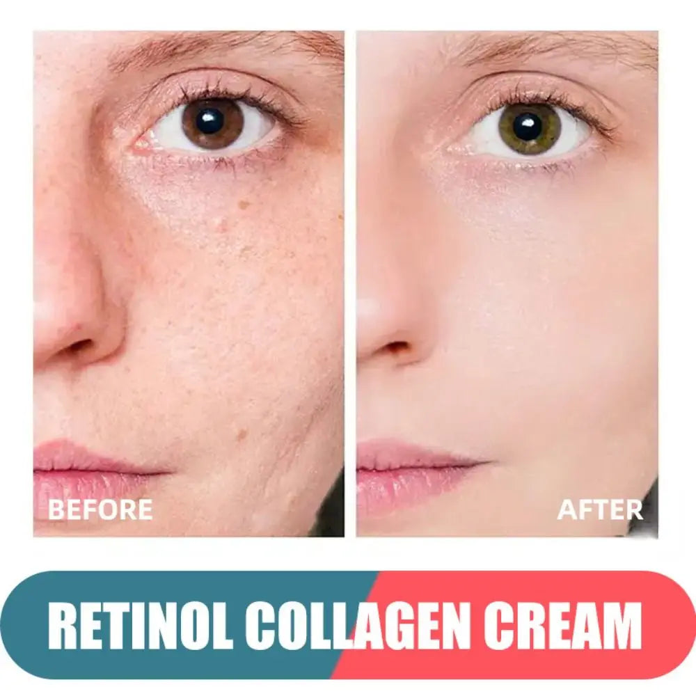 Crema facial antiarrugas de Retinol, crema facial antienvejecimiento hialurónica con vitamina a, crema hidratante blanqueadora para el cuidado de la piel antiarrugas