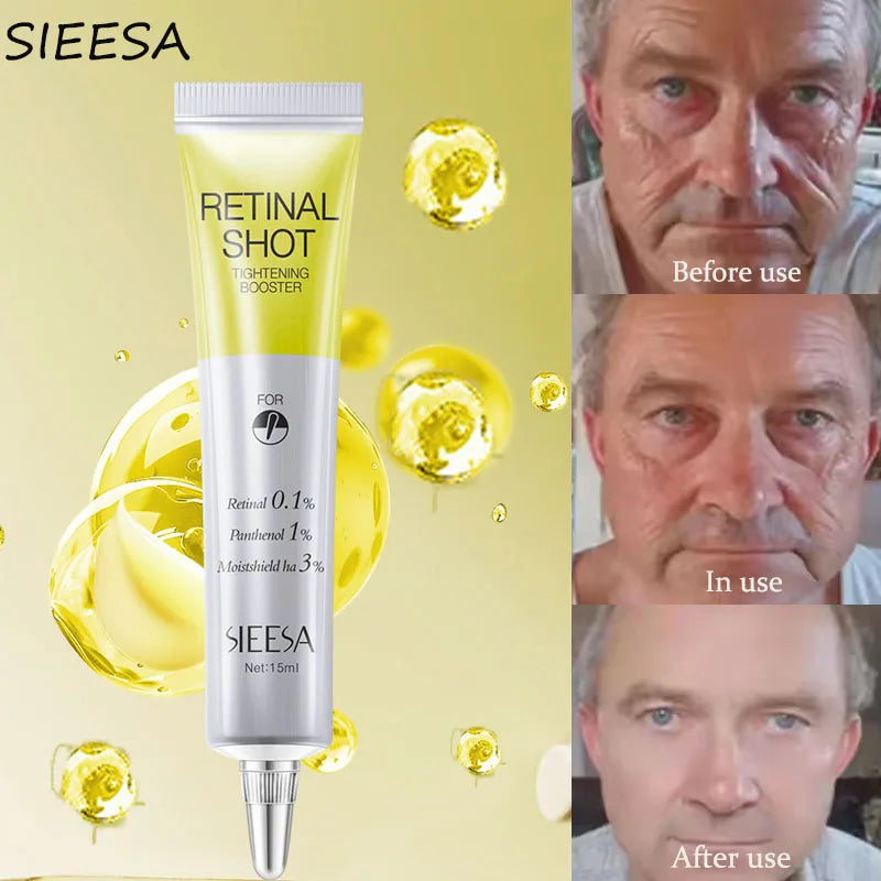 Retinol Anti-wrinkle Cream Collagen Anti-Aging 