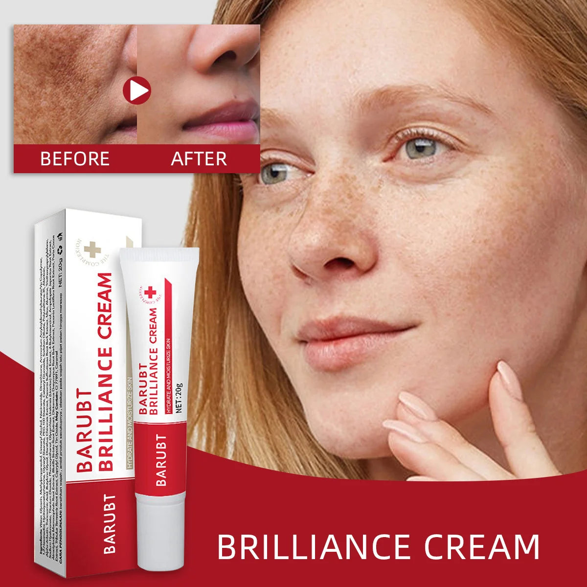Melasma Dark Spots Corrector 20g - Whitening Freckle Removal Face Cream, Lighten Melanin Pigmentation Anti-Aging Brighten