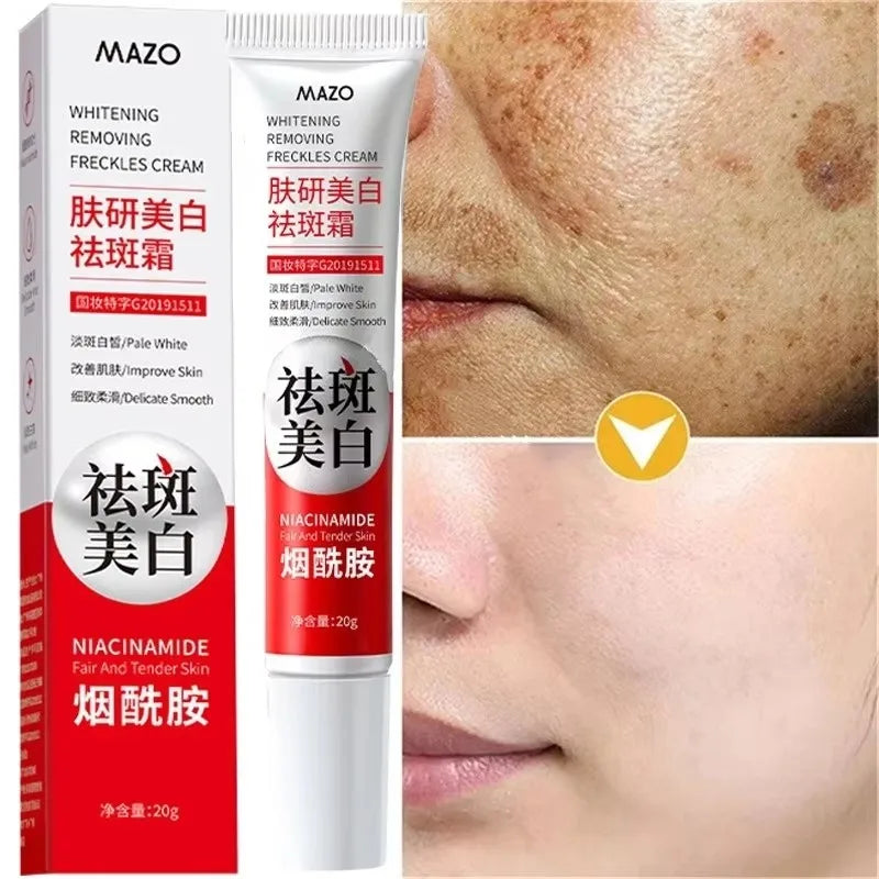 Potente Crema Blanqueadora Quitamanchas Ilumina la Piel Rápidamente Elimina la Pigmentación de Melanina, el Melasma y las Manchas Oscuras Cuidado de la Piel Coreano