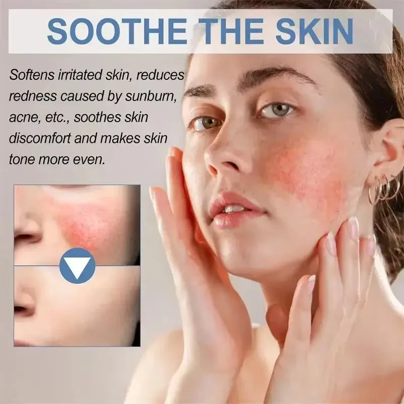 Mascarilla reparadora de enrojecimiento Facial, mejora rápida la sequedad de la piel sensible, suero calmante hidratante, eliminación de Rosacea de sangre roja, cuidado de belleza