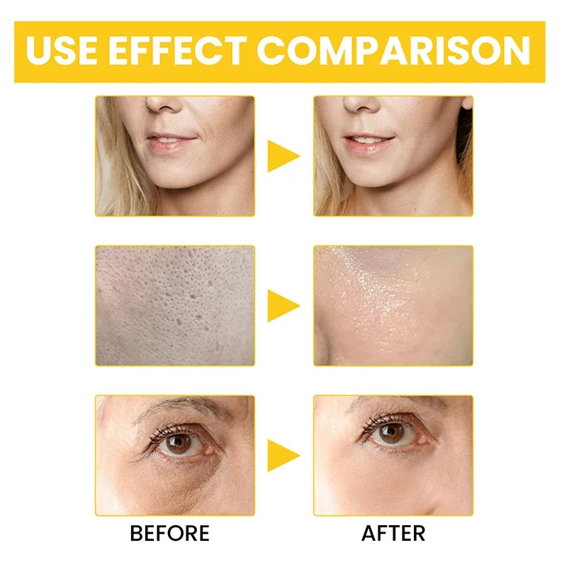 Esencia antiarrugas de Retinol que reduce las líneas finas, levanta la piel, mejora la embotamiento, elimina las arrugas faciales, hidrata el cuidado