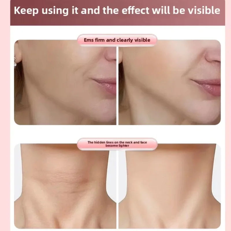 Rodillo Facial Adelgazante Pulchritudinous, Masajeador Facial en Forma de V para Reafirmar y Levantar el Rostro