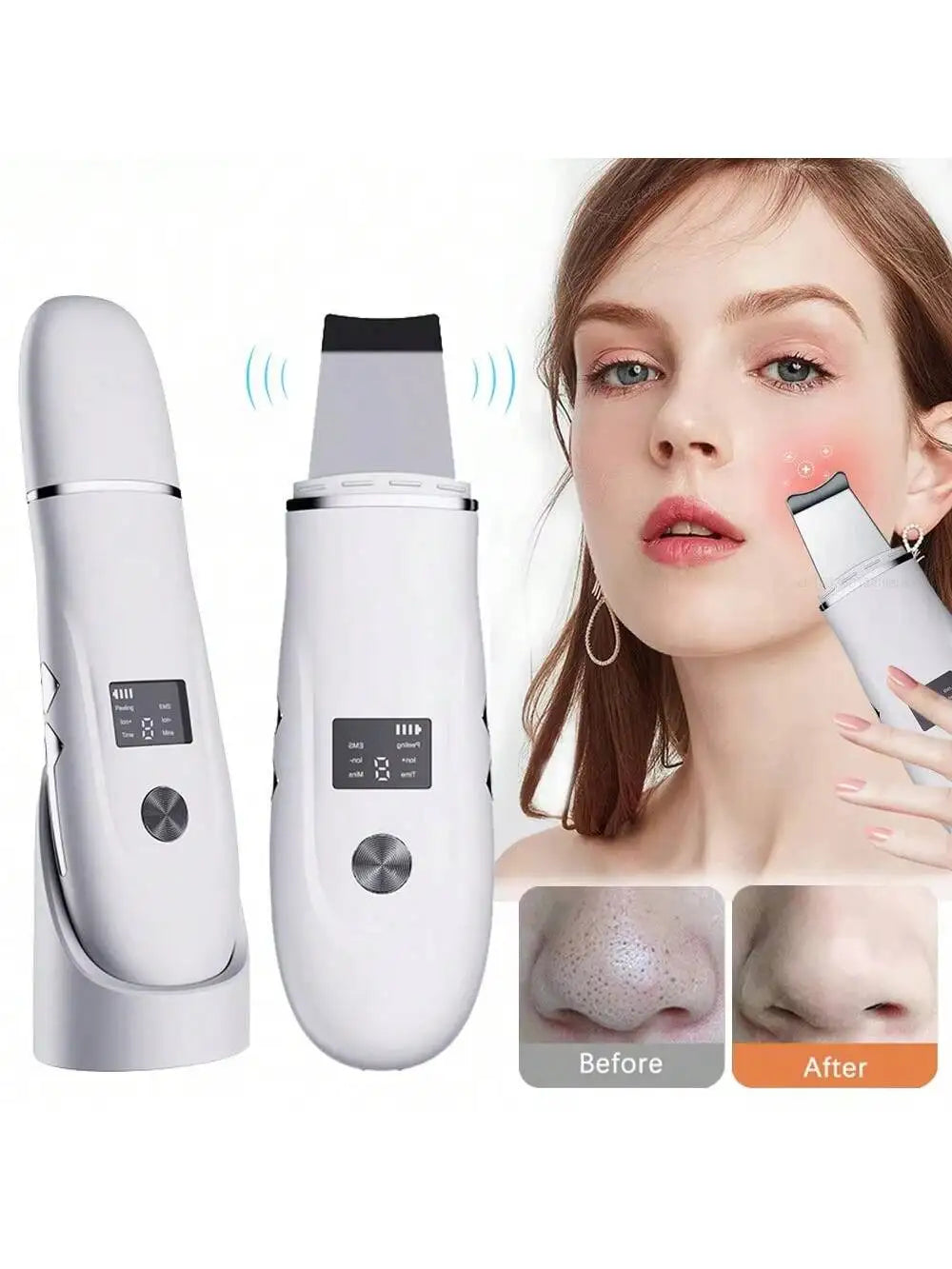 Espátula Ultrasónica de Limpieza Facial