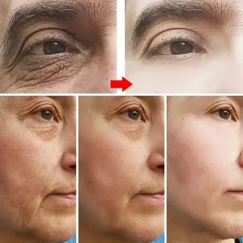 Retinol-crema facial eficaz para eliminar arrugas, reafirmante, antienvejecimiento, decoloración de líneas finas, hidrata, blanquea, reparación, esencia para el cuidado de la piel