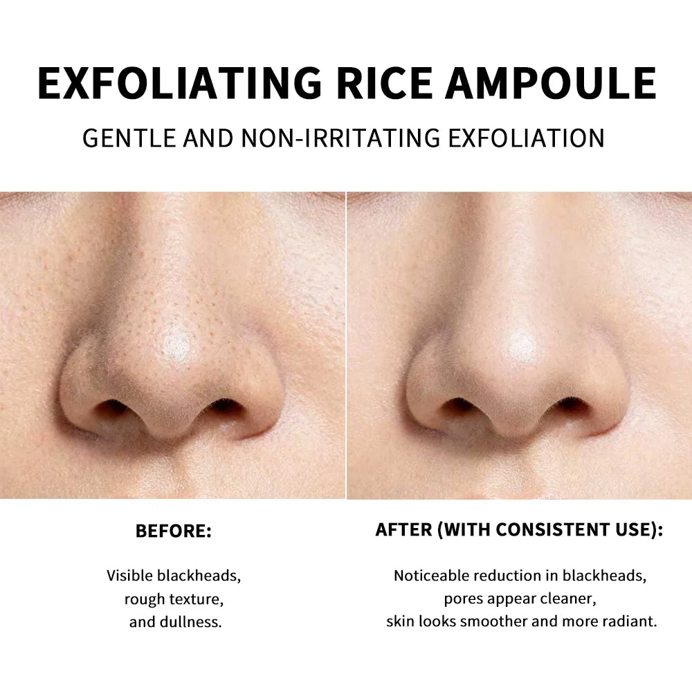 Ampolla Exfoliante Suave de Arroz