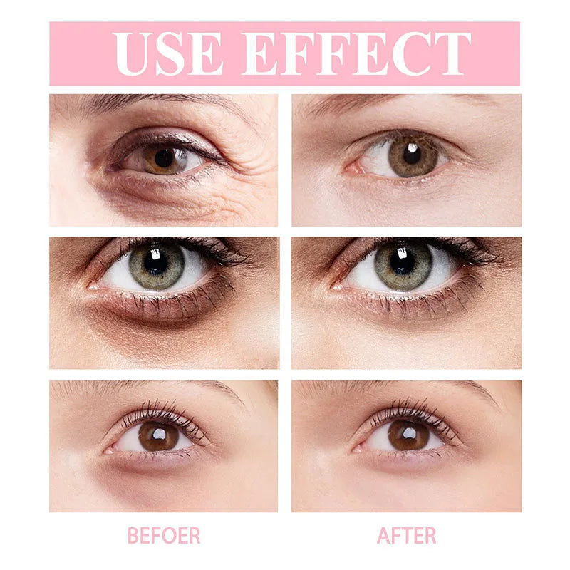 Retinol Eye Cream Balm Stick Enhance Elasticity Smooth Skin Reduce Fine Lines Improve Eye Bags Dark Circles Moisturizing Firming