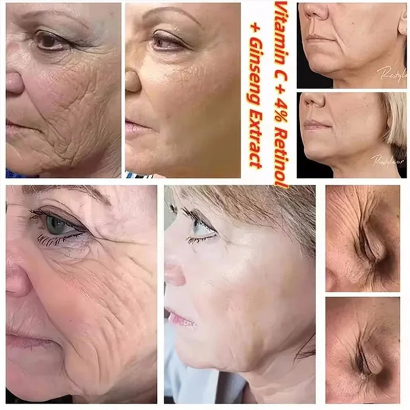 Instant Wrinkle Remover Face Serum Anti Aging Firming Lifting Fade Fine Lines Whitening Moisturizing Tighten Korean Skin Care