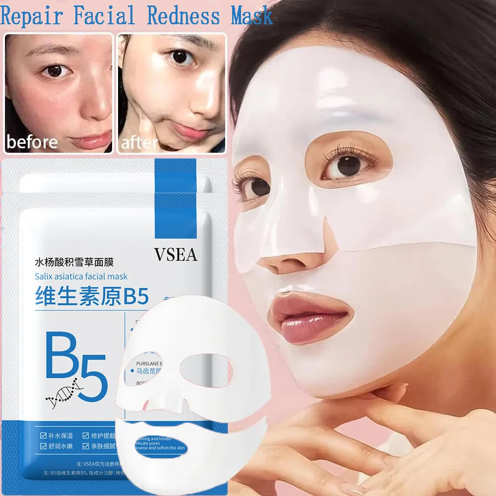 Mascarilla reparadora de enrojecimiento Facial, mejora rápida la sequedad de la piel sensible, suero calmante hidratante, eliminación de Rosacea de sangre roja, cuidado de belleza