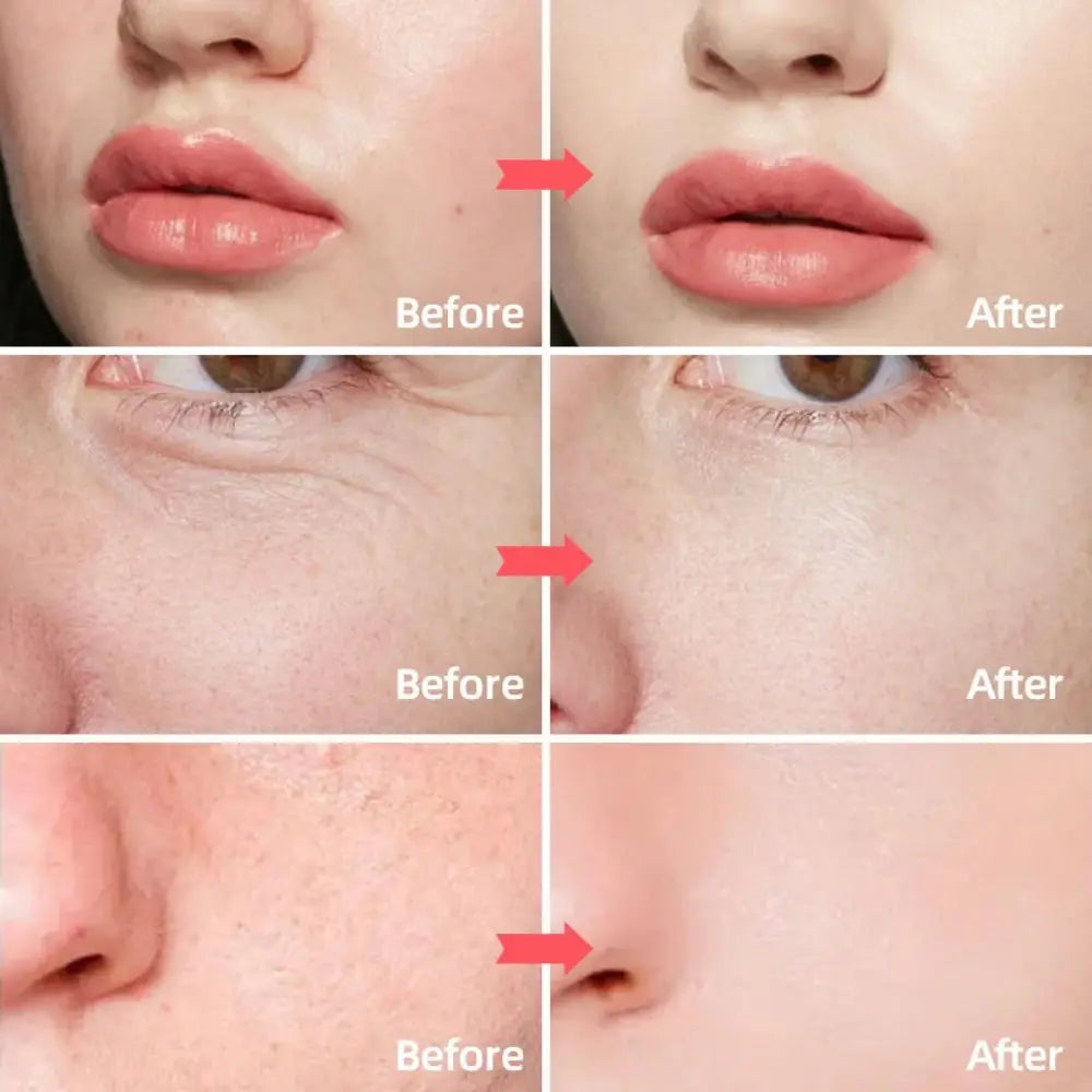 Crema facial antiarrugas de Retinol, crema facial antienvejecimiento hialurónica con vitamina a, crema hidratante blanqueadora para el cuidado de la piel antiarrugas