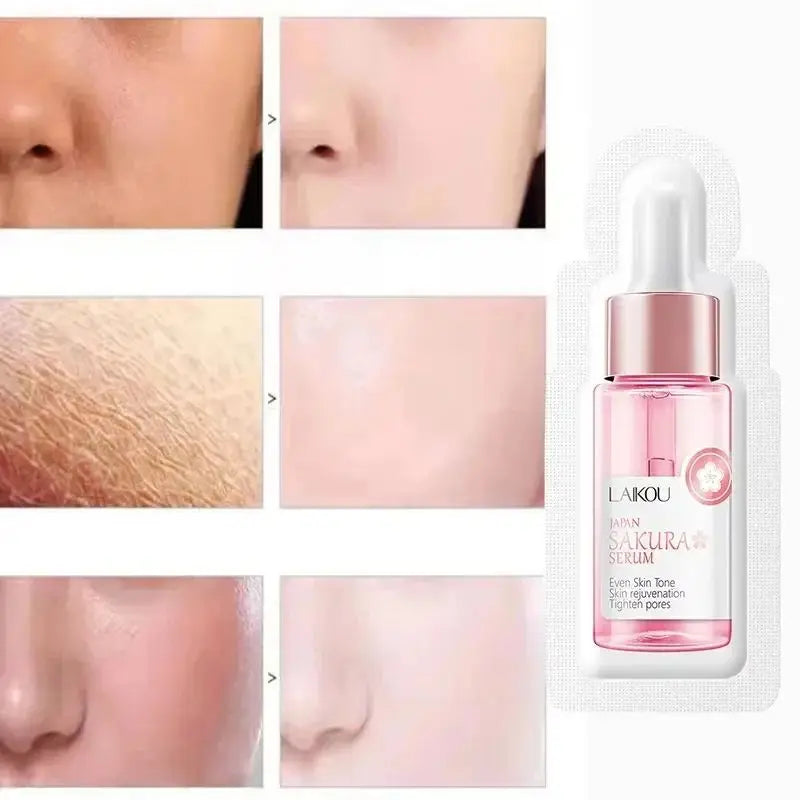 Sérum facial blanqueador con extracto de flor de cerezo (sakura), antiedad, que reduce las líneas de expresión, minimiza los poros, mejora la pigmentación por melanina y la piel opaca. Hidrata e ilumina tu piel.