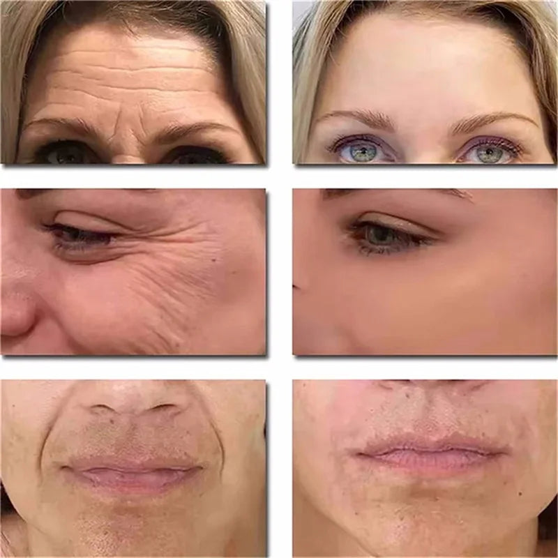 Instant Wrinkle Remover Face Serum Anti Aging Firming Lifting Fade Fine Lines Whitening Moisturizing Tighten Korean Skin Care