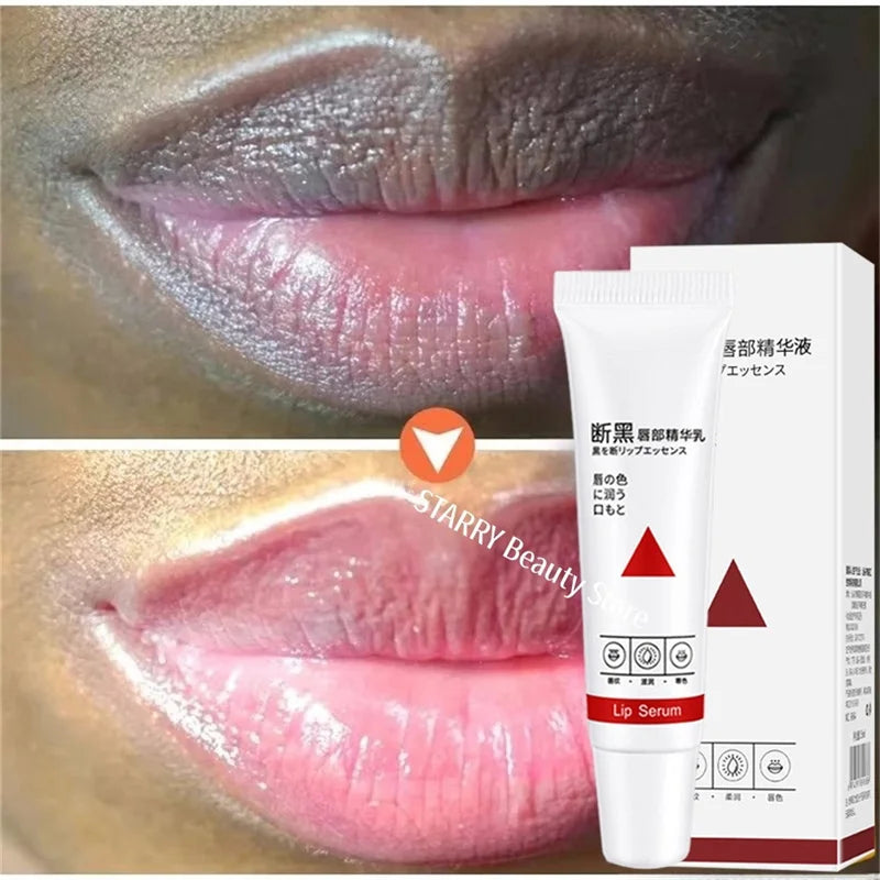 Remove Dark Lip Balm Fast Lightening Pink Lip Exfoliating Fade Lip Line Dead Skin Moisturizer Korean Care Products Beauty Health