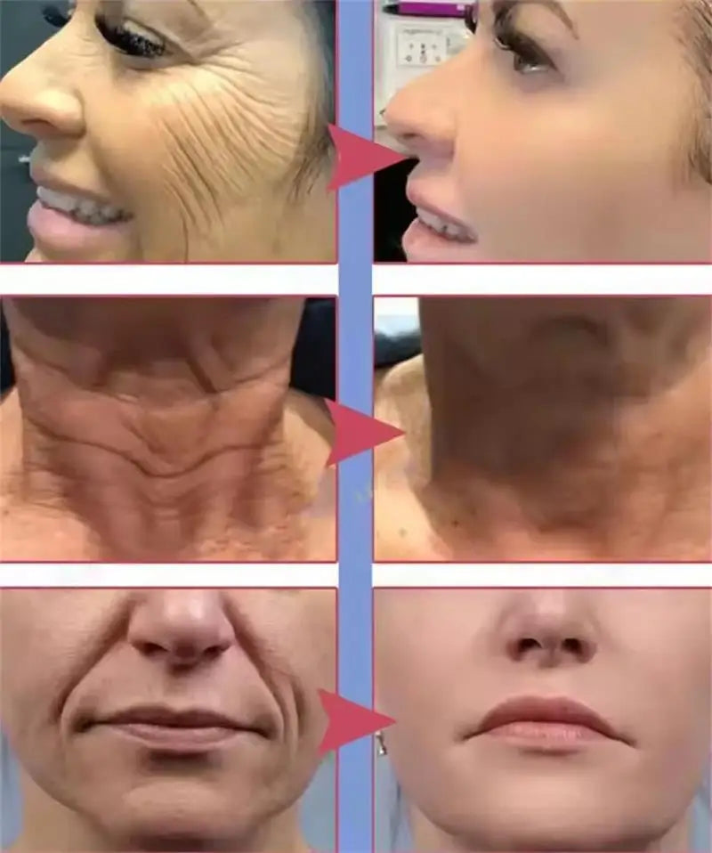 Retinol Anti-wrinkle Cream Collagen Anti-Aging 