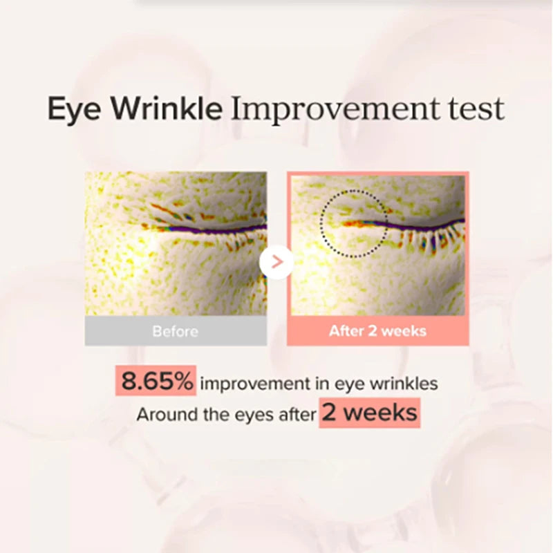 Crema de Ojos con Retinol Coreano, Hidratante, Antiarrugas, Aclarante, Reduce Líneas Finas, Refrescante, Espuma Limpiadora de Baja Irritación