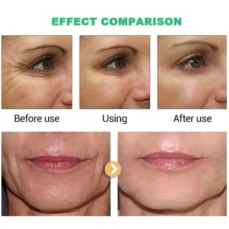 Retinol-crema facial eficaz para eliminar arrugas, reafirmante, antienvejecimiento, decoloración de líneas finas, hidrata, blanquea, reparación, esencia para el cuidado de la piel