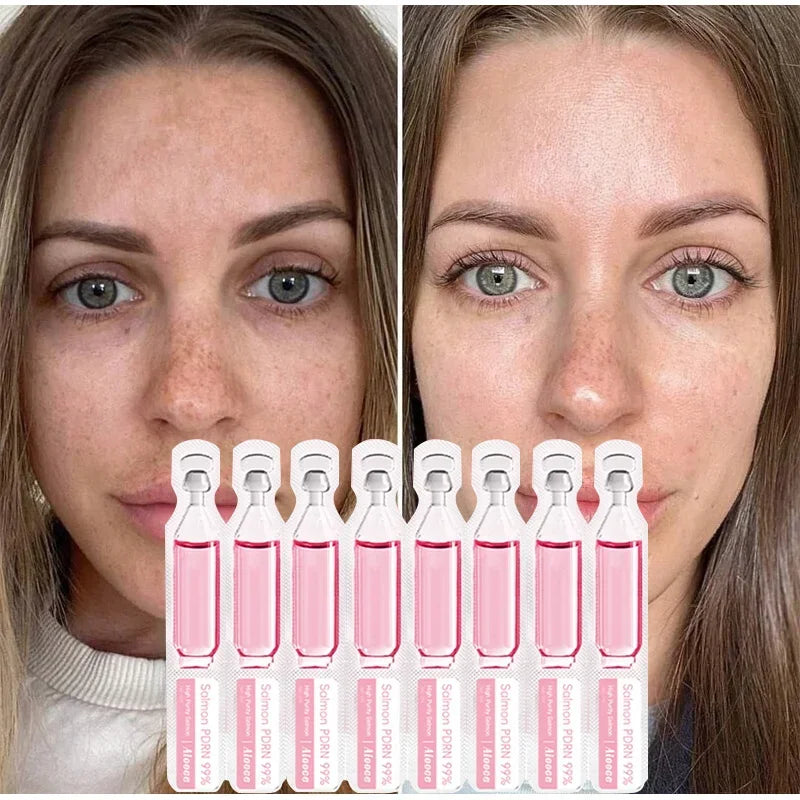 Esencia de péptido de proteína de suero de salmón, 2ml X 10 Uds., antienvejecimiento, reparación de arrugas, hidratante y iluminador, cuidado de refuerzo de colágeno facial