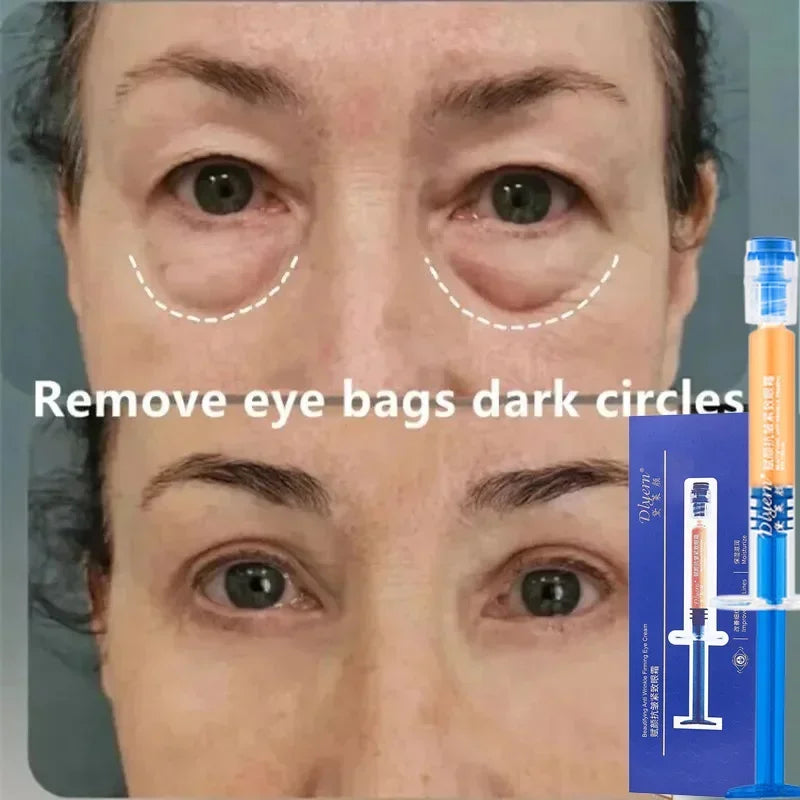 Retinol-crema facial eficaz para eliminar arrugas, reafirmante, antienvejecimiento, decoloración de líneas finas, hidrata, blanquea, reparación, esencia para el cuidado de la piel